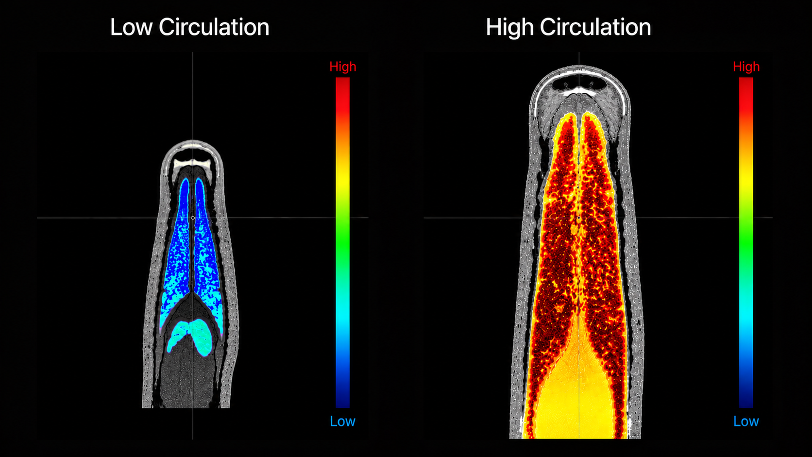 Low vs High blood flow comparison